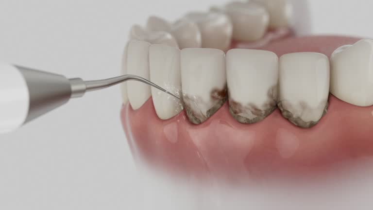 Reliable Dental contractor in Demarest, NJ by Smile Center Dentistry